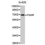 Western blot - FSHR antibody from Signalway Antibody (38614) - Antibodies.com