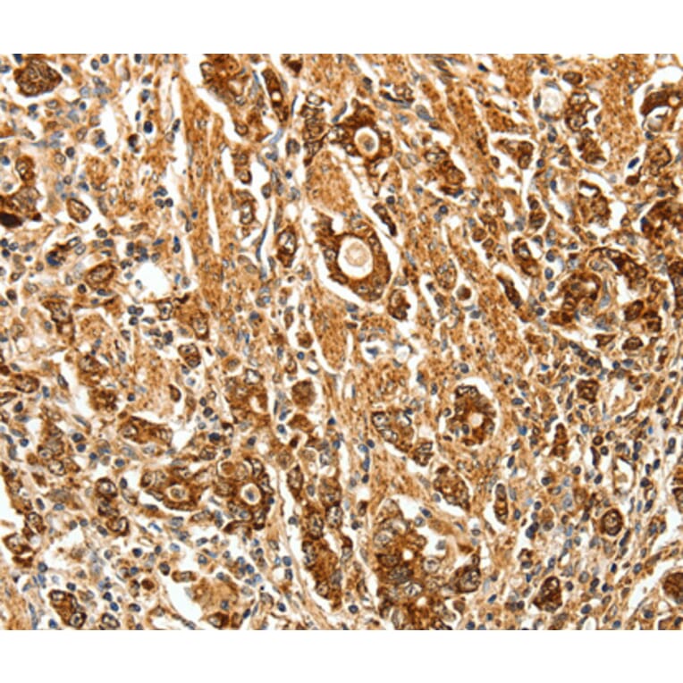 Immunohistochemistry - FSHR antibody from Signalway Antibody (38614) - Antibodies.com