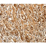 Immunohistochemistry - FSHR antibody from Signalway Antibody (38614) - Antibodies.com