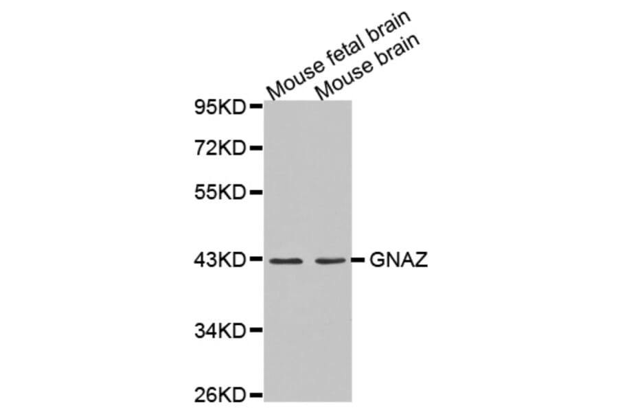 Western blot - GNAZ antibody from Signalway Antibody (38615) - Antibodies.com