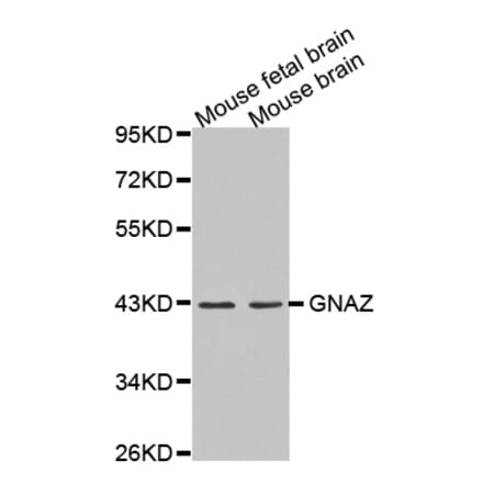 Western blot - GNAZ antibody from Signalway Antibody (38615) - Antibodies.com