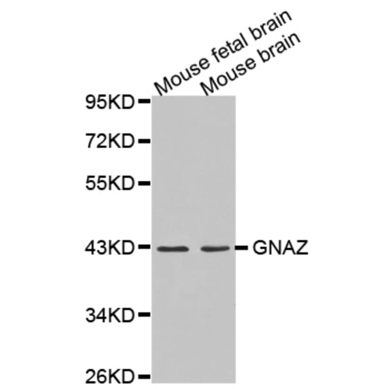 Western blot - GNAZ antibody from Signalway Antibody (38615) - Antibodies.com