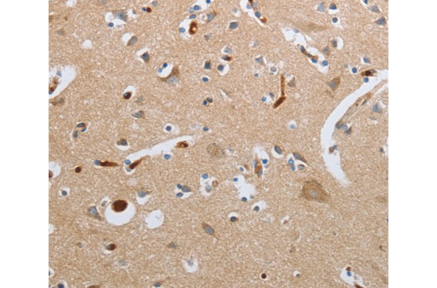 Immunohistochemistry - GNAZ antibody from Signalway Antibody (38615) - Antibodies.com
