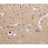 Immunohistochemistry - GNAZ antibody from Signalway Antibody (38615) - Antibodies.com