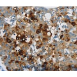Immunohistochemistry - LCN2 antibody from Signalway Antibody (38617) - Antibodies.com