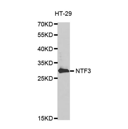 Western blot - NTF3 antibody from Signalway Antibody (38620) - Antibodies.com