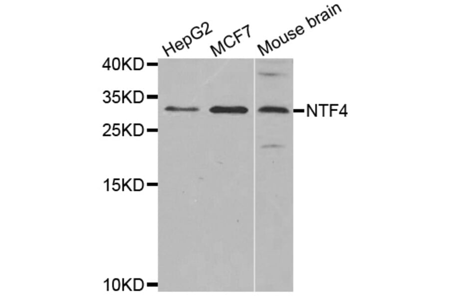 Western blot - NTF4 antibody from Signalway Antibody (38621) - Antibodies.com