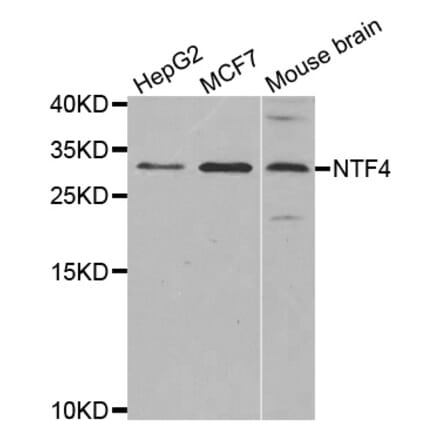 Western blot - NTF4 antibody from Signalway Antibody (38621) - Antibodies.com