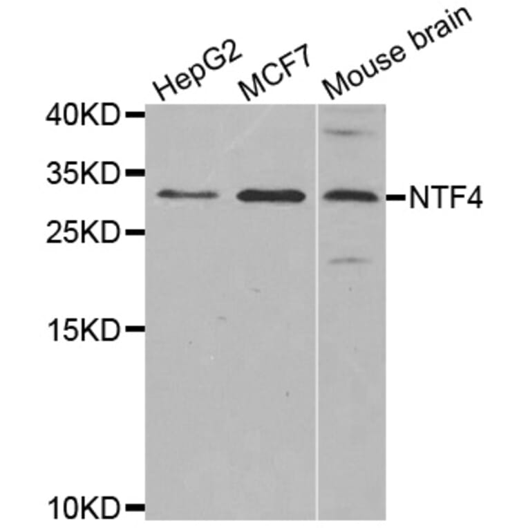 Western blot - NTF4 antibody from Signalway Antibody (38621) - Antibodies.com