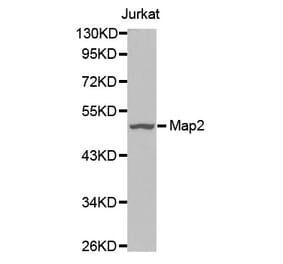 Western blot - Map2 antibody from Signalway Antibody (38634) - Antibodies.com