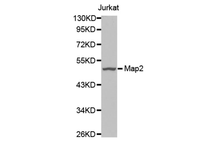 Western blot - Map2 antibody from Signalway Antibody (38634) - Antibodies.com