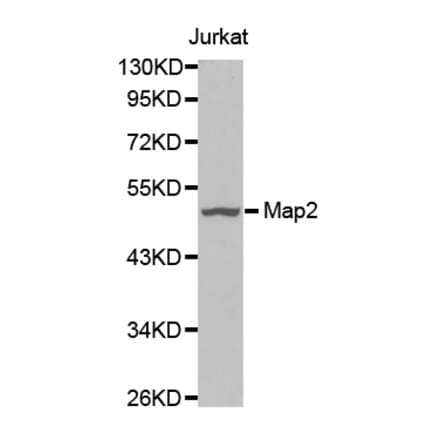 Western blot - Map2 antibody from Signalway Antibody (38634) - Antibodies.com