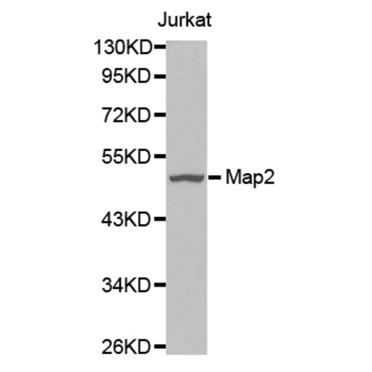 Western blot - Map2 antibody from Signalway Antibody (38634) - Antibodies.com