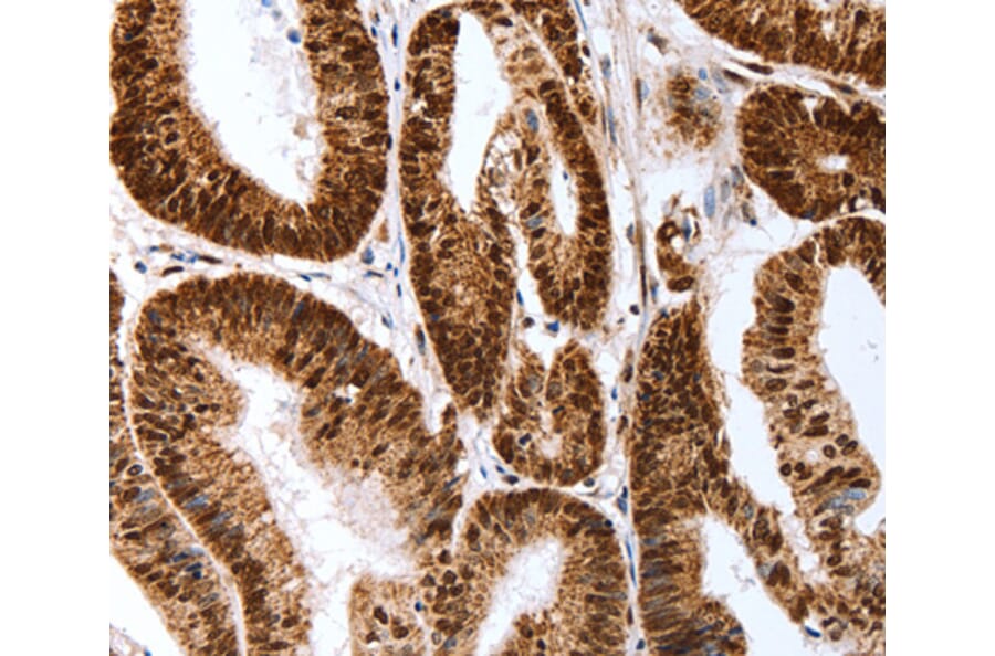 Immunohistochemistry - Map2 antibody from Signalway Antibody (38634) - Antibodies.com