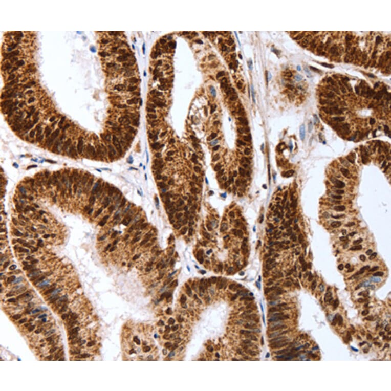 Immunohistochemistry - Map2 antibody from Signalway Antibody (38634) - Antibodies.com