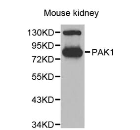 Western blot - PAK1 antibody from Signalway Antibody (38635) - Antibodies.com