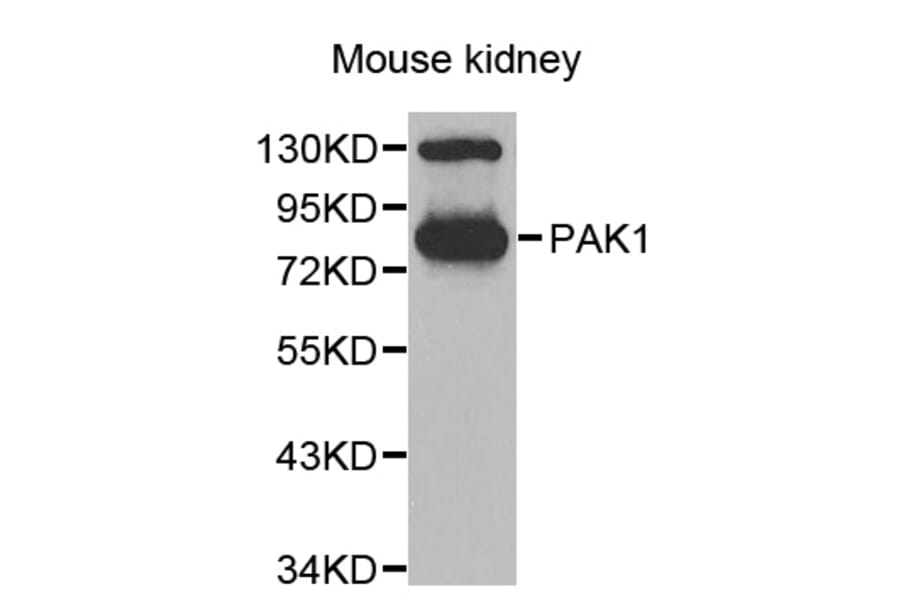Western blot - PAK1 antibody from Signalway Antibody (38635) - Antibodies.com