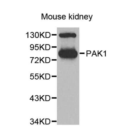 Western blot - PAK1 antibody from Signalway Antibody (38635) - Antibodies.com