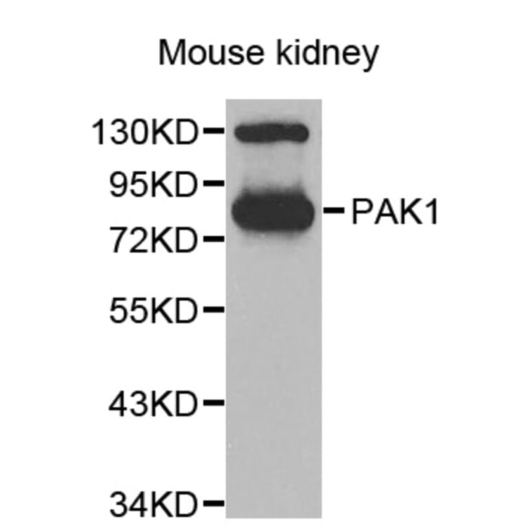 Western blot - PAK1 antibody from Signalway Antibody (38635) - Antibodies.com