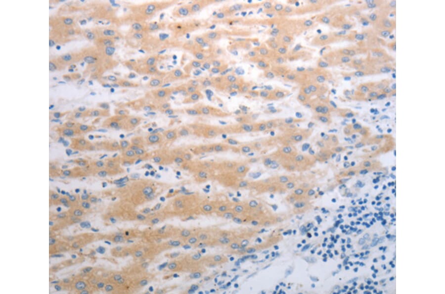 Immunohistochemistry - PAK1 antibody from Signalway Antibody (38635) - Antibodies.com