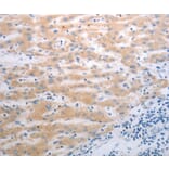 Immunohistochemistry - PAK1 antibody from Signalway Antibody (38635) - Antibodies.com