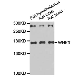 Western blot - WNK3 antibody from Signalway Antibody (38670) - Antibodies.com