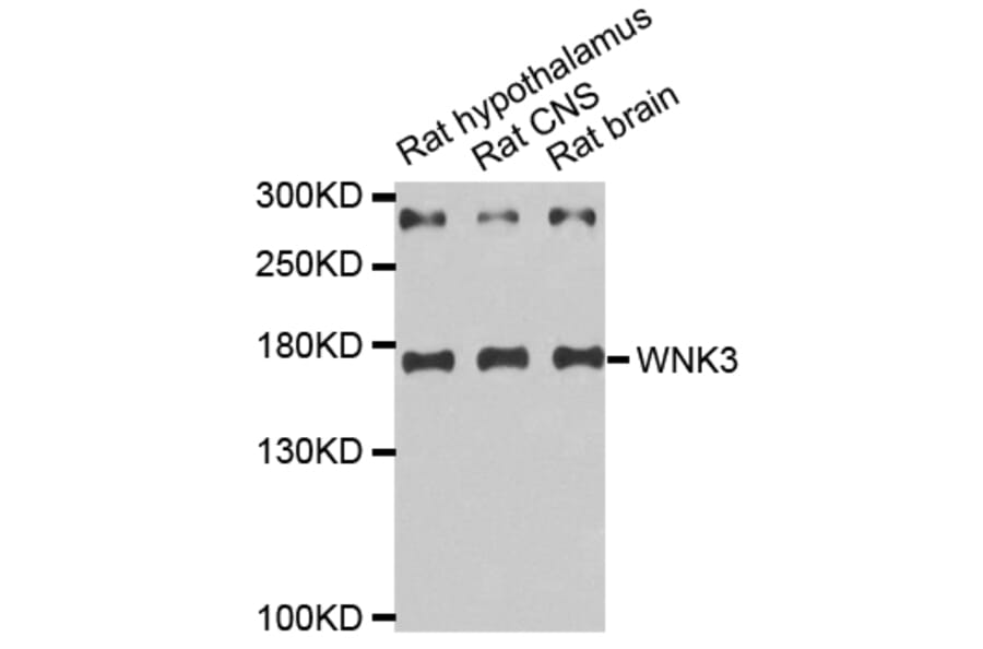 Western blot - WNK3 antibody from Signalway Antibody (38670) - Antibodies.com