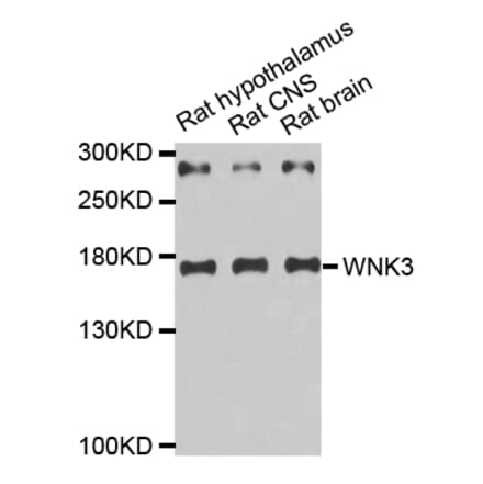 Western blot - WNK3 antibody from Signalway Antibody (38670) - Antibodies.com