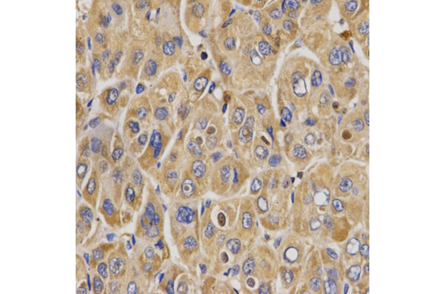 Immunohistochemistry - WNK3 antibody from Signalway Antibody (38670) - Antibodies.com