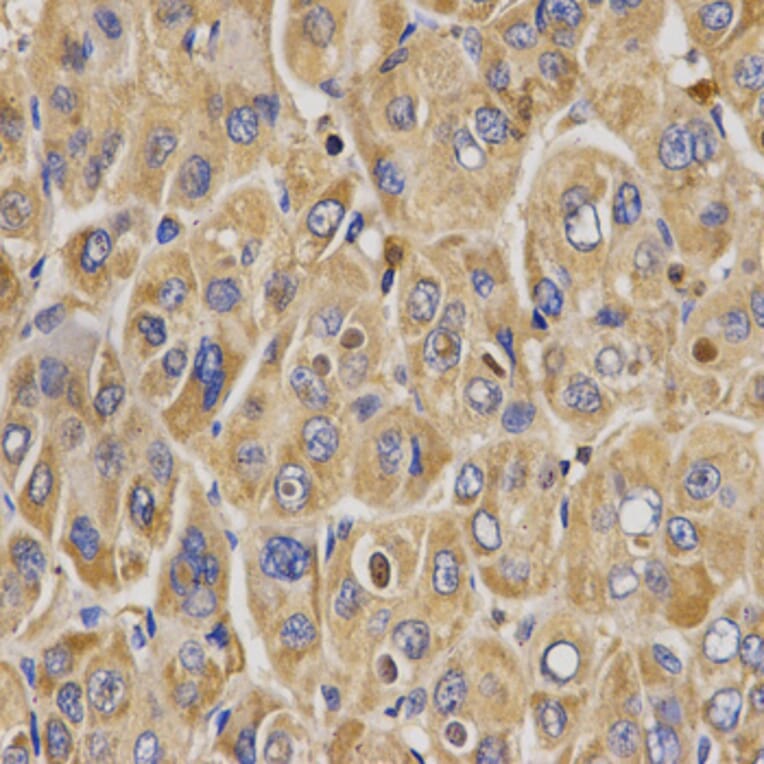 Immunohistochemistry - WNK3 antibody from Signalway Antibody (38670) - Antibodies.com