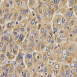 Immunohistochemistry - WNK3 antibody from Signalway Antibody (38670) - Antibodies.com