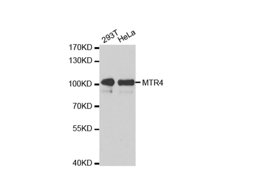 Western blot - MTR4 antibody from Signalway Antibody (38672) - Antibodies.com