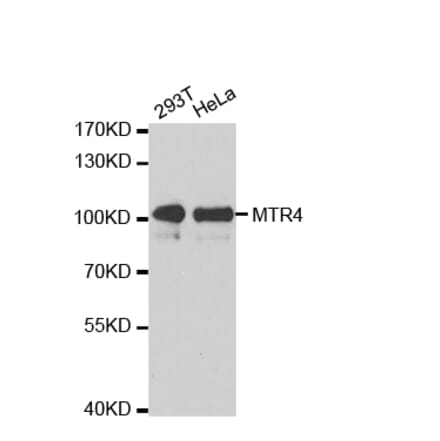 Western blot - MTR4 antibody from Signalway Antibody (38672) - Antibodies.com