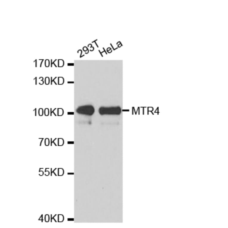 Western blot - MTR4 antibody from Signalway Antibody (38672) - Antibodies.com
