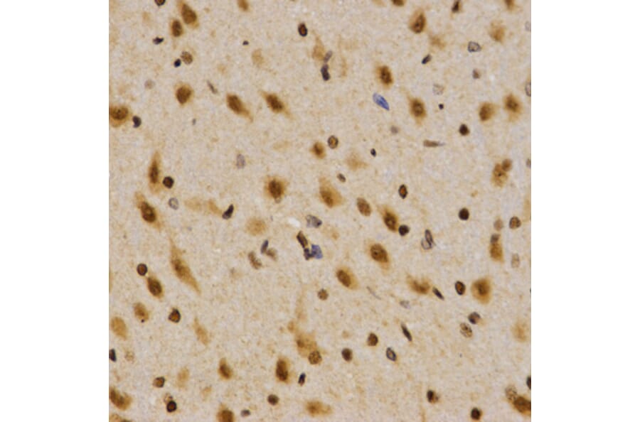 Immunohistochemistry - MTR4 antibody from Signalway Antibody (38672) - Antibodies.com