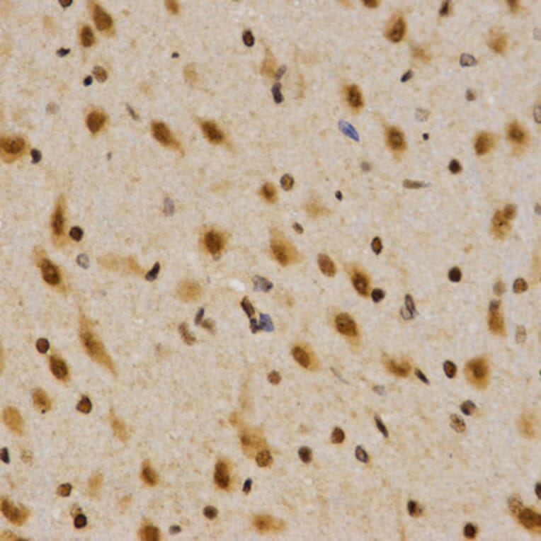 Immunohistochemistry - MTR4 antibody from Signalway Antibody (38672) - Antibodies.com