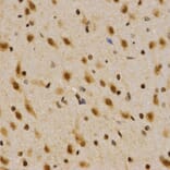 Immunohistochemistry - MTR4 antibody from Signalway Antibody (38672) - Antibodies.com