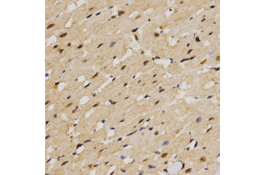 Immunohistochemistry - MTR4 antibody from Signalway Antibody (38672) - Antibodies.com