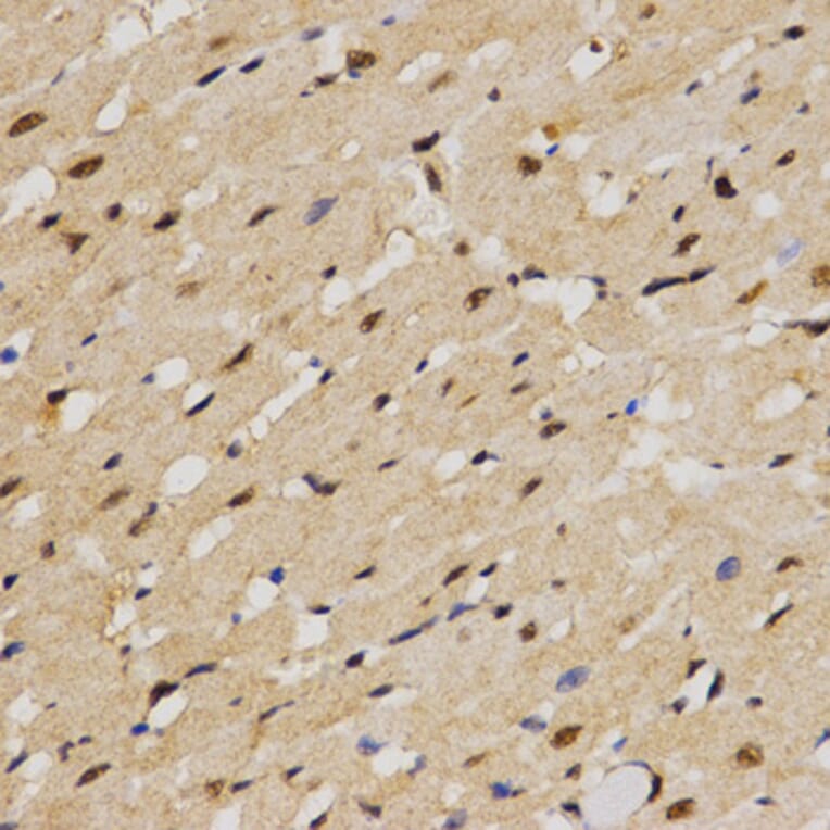 Immunohistochemistry - MTR4 antibody from Signalway Antibody (38672) - Antibodies.com