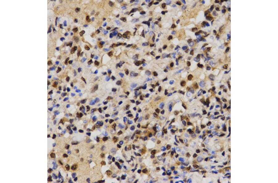 Immunohistochemistry - MTR4 antibody from Signalway Antibody (38672) - Antibodies.com
