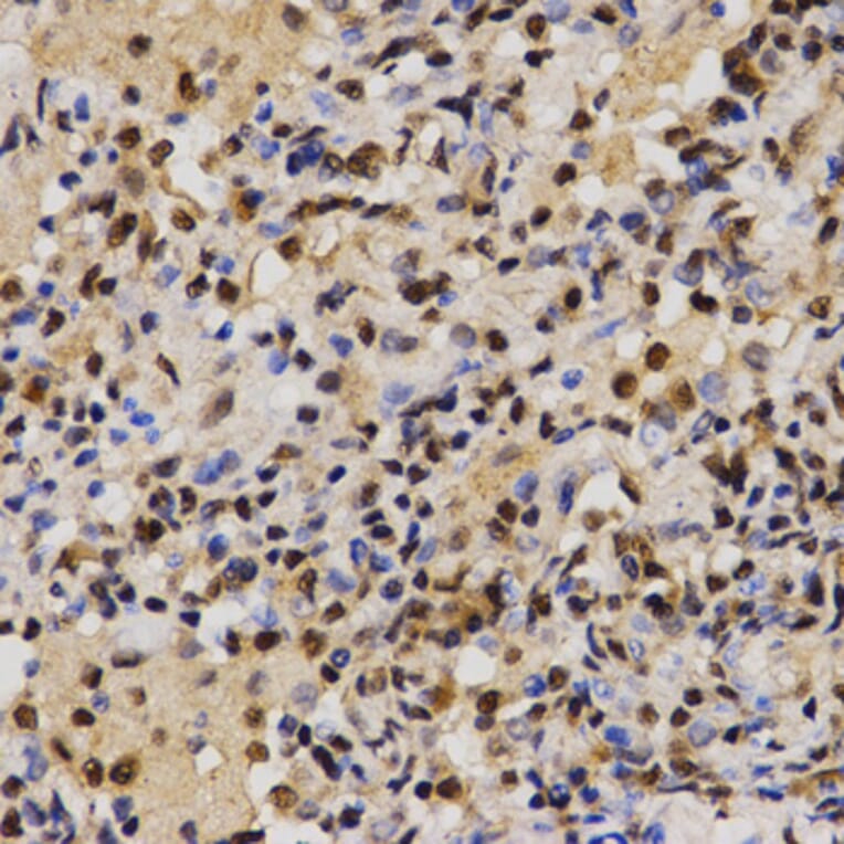 Immunohistochemistry - MTR4 antibody from Signalway Antibody (38672) - Antibodies.com