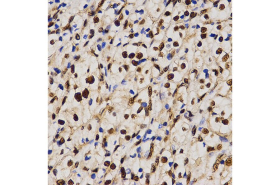 Immunohistochemistry - MTR4 antibody from Signalway Antibody (38672) - Antibodies.com