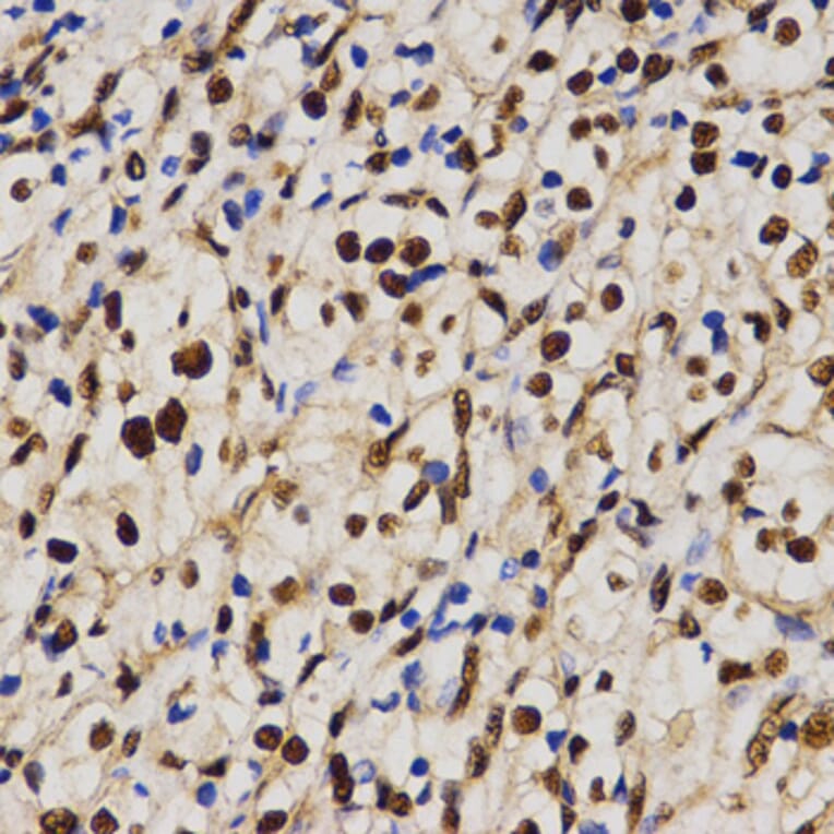 Immunohistochemistry - MTR4 antibody from Signalway Antibody (38672) - Antibodies.com