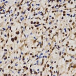Immunohistochemistry - MTR4 antibody from Signalway Antibody (38672) - Antibodies.com