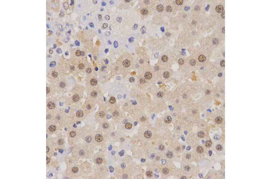 Immunohistochemistry - MTR4 antibody from Signalway Antibody (38672) - Antibodies.com
