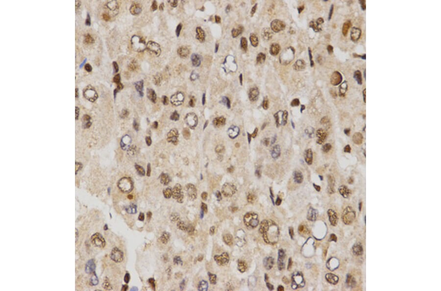 Immunohistochemistry - MTR4 antibody from Signalway Antibody (38672) - Antibodies.com