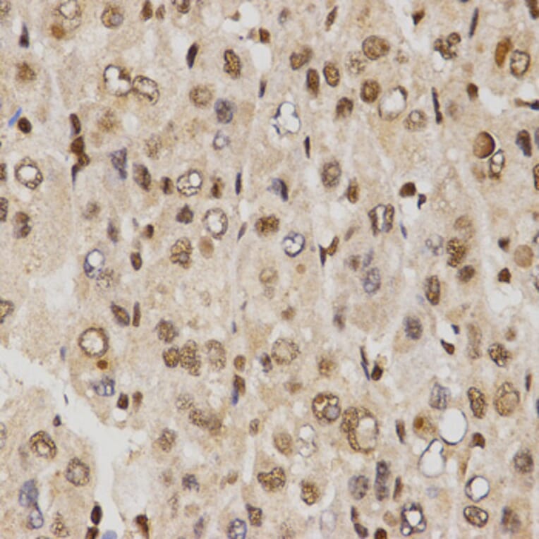 Immunohistochemistry - MTR4 antibody from Signalway Antibody (38672) - Antibodies.com