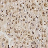 Immunohistochemistry - MTR4 antibody from Signalway Antibody (38672) - Antibodies.com