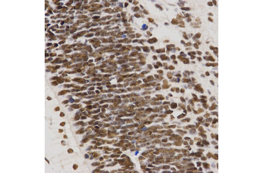 Immunohistochemistry - MTR4 antibody from Signalway Antibody (38672) - Antibodies.com