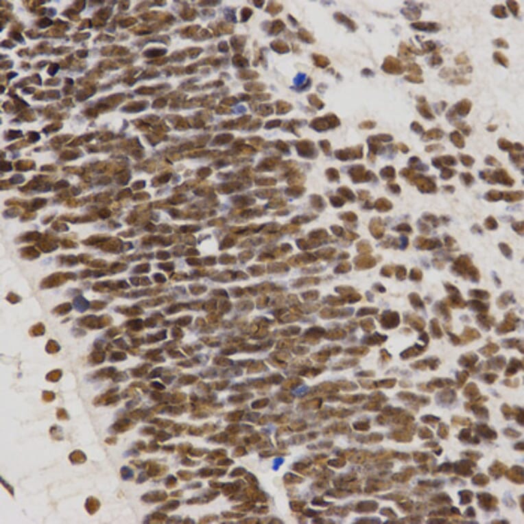 Immunohistochemistry - MTR4 antibody from Signalway Antibody (38672) - Antibodies.com